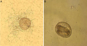 Toxocara canis eggs before administration to the experimental animals. (A) T. canis egg colonized by Trichoderma virens hyphae after culturing in minimal medium at 25°C/15 days. (B) Non-fungus exposed embryonated T. canis egg (40×).