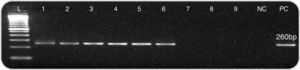 Nested PCR screening of BAL samples forP. jirovecii. Electrophoretic analysis of fragments generated by nested PCR resulted in a characteristic 260-bp fragment for positive samples. The samples were run in 1.5% agarose gels stained with ethidium bromide. L: molecular markers (100bp), lanes 1–6: 260bp fragments (samples positive for P. jirovecii), lanes 7–9: no amplification; NC, negative control; and PC, positive control.