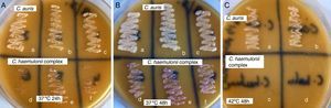 Plates of CHROMagar Candida supplemented with Pal's medium showing confluent growth of white colored colonies of C. auris (a, b and c) and poor growth of light pink colored colonies C. haemulonii var. vulnera (d), C. duobushaemulonii (e) and C. haemulonii (f) after incubation at (A) 37°C for 24h, (B) 37°C for 48h and (C) white colored colonies of C. auris (a, b) and no growth of C. duobushaemulonii (c) and C. haemulonii (d) after incubation at 42°C for 48h.