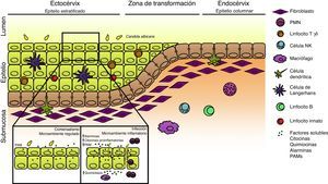 Respuesta inmune innata local en el tracto genital femenino. Esquema del tracto genital femenino que ilustra la ubicación de las diferentes poblaciones celulares. En condiciones de homeostasis el microambiente local se encuentra finamente regulado con concentraciones aumentadas de citocinas antiinflamatorias y péptidos antimicrobianos (PAM) de expresión constitutiva; Candida albicans se encuentra en su estado comensal. La ruptura de este estado de equilibrio debido a la presencia de factores predisponentes o defectos genéticos favorece la morfogénesis fúngica, la expresión de factores de virulencia y el establecimiento de la infección. La liberación de alarminas, PAM, sustancias quimiotácticas y citocinas generan un microambiente inflamatorio con infiltrado celular que, en su conjunto, determinan la aparición de los síntomas de la enfermedad.