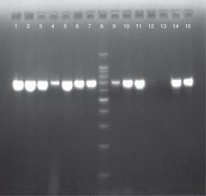 Electroforesis en gel de agarosa al 2% de los productos de PCR-SADH para los aislamientos del CCP. Calles 1, 2, 3, 4, 6, 7, 9, 10, 14 y 15: aislamientos del CCP (716pb). Calle 5: C. parapsilosis ATCC 22019. Calle 8: marcador de peso molecular 100pb. Calle 11: C. parapsilosis ATCC 90018. Calle 12: agua libre de nucleasas. Calle 13: Candida tropicalis ATCC 66029.