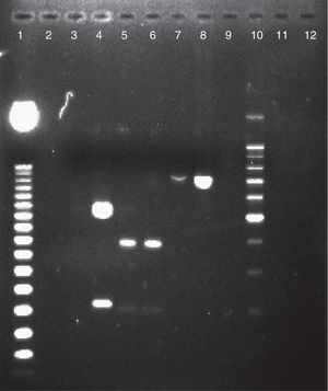 Electroforesis en gel de agarosa al 2% de productos de PCR-SADH digeridos por la enzima de restricción BanI, para la caracterización de las especies del CCP. Calle 1: marcador de peso molecular de 50pb. Calle 2: agua libre de nucleasas. Calle 3: Candida tropicalis ATCC 66029. Calle 4: C. parapsilosis ATCC 22019 (550 y 200pb). Calle 5: aislamiento de C. metapsilosis (400pb). Calle 6: C. metapsilosis ATCC 96144 (400pb). Calle 7: aislamiento de C. orthopsilosis (750pb). Calle 8: C. orthopsilosis ATCC 96139 (750pb). Calle 9: Candida tropicalis ATCC 66029. Calle 10: marcador de peso molecular 100pb. Calles 11 y 12: agua libre de nucleasas.