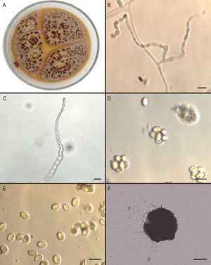 Thermoascus crustaceus ChFC (Chilean Fungal Collection)144. (A) Macroscopic appearance on Potato Dextrose Agar; (B) chains of smooth-walled conidia and phialides; (C) chain of conidia; (D) asci; (E) echinulate ascospores; (F) ascocarp.