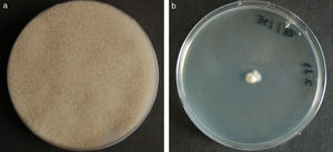 Colonial morphology of the isolate of C. bertholletiae on potato dextrose agar after 7 days at (a) 40°C and (b) 45°C.