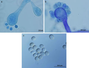 Characteristic immature (a) and mature (b) vesicles of the isolate of C. bertholletiae, covered with globose one-spored sporangioles borne on pedicels. Sporangiospores (c). Lactophenol cotton blue stain.