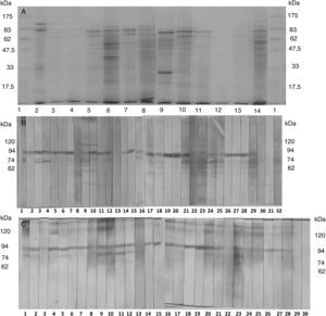 (A) Electrophoretic profile of the antigens of H. capsulatum, obtained according to Kaufman and Standard (1978), in agar-Sabouraud-dextrose, 27°C, 33 days of culture. Lane 1: molecular weight standard; Lane 2: antigen of reference; Lane 3: Ag Hc 49; Lane 4: Ag Hc 200; Lane 5: Ag Hc 212; Lane 6: Ag Hc 268; Lane 7: Ag Hc 299; Lane 8: Ag Hc 340; Lane 9: Ag Hc 361; Lane 10: Ag Hc 406; Lane 11: Ag Hc 584; Lane 12: Ag Hc 802; Lane 13: Ag Hc 2030 and Lane 14: Ag Hc RP. (B) Immunoreactivity pattern of circulating IgG anti-H.capsulatum antibodies from patients suffering histoplasmosis (1–22), H.capsulatum-infected but healthy patients (22–28), and sera from healthy subjects (29–32) against antigens derived from isolate 200, 10-fold concentrate, according to Kaufman and Standard, cultured in Sabouraud-dextrose agar, 27°C, for 33 days. (C) Immunoreactivity pattern of circulating IgG anti-H.capsulatum antibodies from patients suffering histoplasmosis (1–20), H. capsulatum-infected but healthy patients (21–27), and sera from healthy subjects (28–30) against antigens derived from isolate 200, 10-fold concentrate, according to Kaufman and Standard, cultured in Sabouraud-dextrose agar, 27°C, for 15 days.