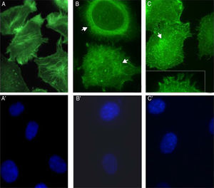 Actin cytoskeleton alterations in epithelial cell induced by proteases of S. schenckii. (A) Epithelial cell control. (B) After 45min or (C) 90min of incubation with proteases; and (A′, B′ and C′) cell nuclei labeled with DAPI respectively. Note the actin disorganization (box (C) and arrow) in the cells.