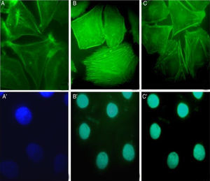 Inhibition of the protease activity of S. schenckii proteases on actin cytoskeleton of epithelial cells. (A) Control. After 90min of incubation with proteases plus PMSF (B) or E64 (C) and cell nuclei labeled with DAPI (A′, B′ and C′) respectively.