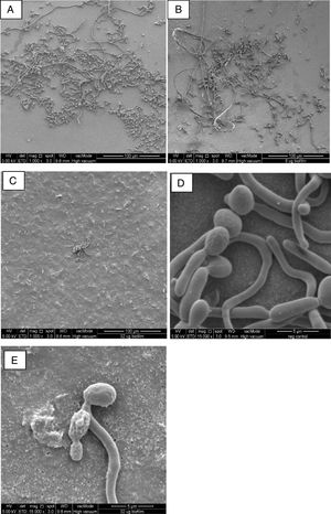 FESEM images of C. albicans biofilm cultures upon exposure to AbA for 2.5h. (A) Untreated biofilm culture (1000×); (B) biofilm culture treated with 8μg/ml AbA (1000×); (C) biofilm culture treated with 32μg/ml AbA (1000×); (D) untreated biofilm culture (15,000×); (E) biofilm culture treated with 32μg/ml AbA (15,000×).