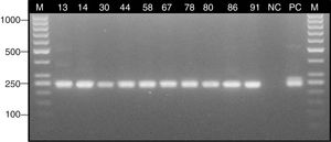 Detection of the Aspergillus gene fragment encoding the 18S rRNA subunit with the nested PCR technique. Lane: M, 100-bp molecular size marker (Thermo Scientific); 13–91, positive samples; NC, negative control; PC, positive control (Aspergillus fumigatus ATCC 14110).