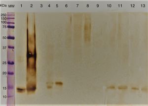 Immunoblotting of A. alternata and related genera; molecular weight marker protein (1), A. alternata (2), rAlt a 1 protein (3), E. nigrum (4), S. botryosum (5), U. chartarum (6), C. lunata (7), C. cladosporioides (8), A. fumigatus AF-54 (9), P. chrysogenum(10) and A. alternata airborne strains (11–14).