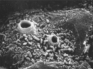 Epidermis of a toad killed by chytridiomycosis in which the discharge tubes of the sporangia of B. dendrobatidis are observed. Scanning electron microscope. Photo courtesy of Jaime Bosch.