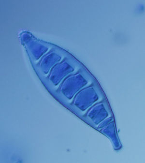 Macroconidium of Microsporum canis. This species is the main causal agent of ringworm in cats and dogs.