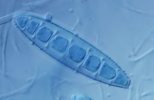 Macroconidium of Paraphyton cookei (formerly Microsporum cookei). This species does not produce ringworm, but it can be isolated from the fur of animals.
