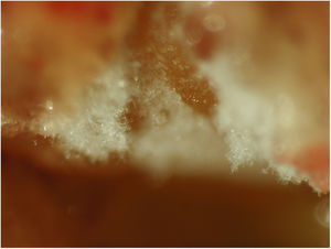 Whitish-coloured mycelium from a fungal plaque detected in a guttural pouch of a horse.