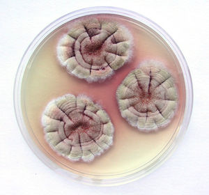 Colonies on Czapek yeast extract agar at 37°C of a strain of Aspergillus nidulans isolated from a case of guttural pouch mycosis. Note the exudate present in minute droplets on the surface of the colonies and the soluble pigment around the colonies, both reddish in colour, characteristically produced by this species in this medium.