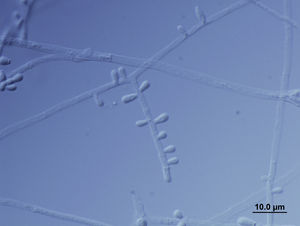 Microscopic observation of Trichophyton erinacei stained with Lactofenol blue solution.