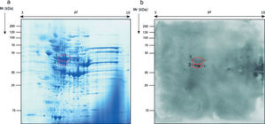 Analysis of 2-DE of the total extract of Mucor circinelloides. (a) Stained with Coomassie Brilliant Blue and (b) WB obtained with the sera of immunocompromised infected mice.