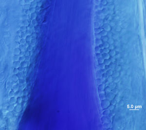 Direct microscopic examination of an area near the hair bulb. Numerous arthroconidia can be seen around the hair, which are the infectious fungal elements responsible for the spread of the disease. This infection pattern is common in animal dermatophytoses and is called ectothrix. Lactophenol blue stain.