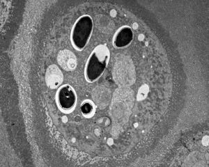 Epithelial cell of the ventriculus of a bee infested by Nosema ceranae. Photo courtesy of Mariano Higes (CIAPA-IRIAF).