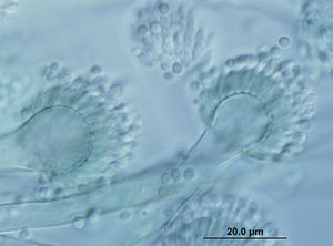 Conidial heads of Aspergillus fumigatus. Their conidia are among the smallest in the Aspergillus species, measuring 2–3μm in diameter.