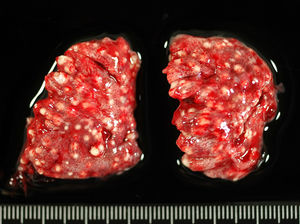 Granulomatous pneumonia caused by Aspergillus fumigatus. Note the presence of multiple nodules in the lungs of a broiler. Photo courtesy of Natàlia Majó (UAB).