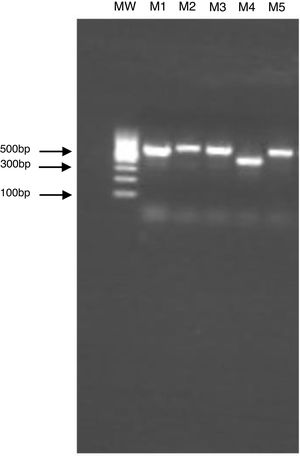 Electrophoresis of PCR products of the ITS region in 1.5% agarose gel. M1: Candida albicans, M2: Candida albicans, M3: Candida albicans, M4: Candida haemulonii, M5: Candida albicans, and MW: molecular weight marker. The gel electrophoresis was done to verify the size and quality of the PCR products prior to sequencing.
