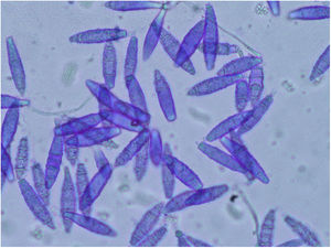 Fusiform macroconidia with thin and echinulated walls (1000×, Cotton blue staining).