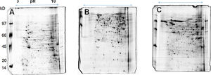 Protein profile in 2D gel electrophoresis stained with colloidal Coomassie blue. A: U937 monocytes; B: P. lutzii Pb01; and C: U937+Pb01.