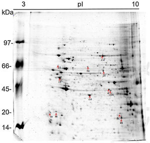 Analysis of proteins in 2D gel electrophoresis of U937 monocytes. Proteins differentially expressed in U937 and U937+P. lutzii Pb01 are marked with red arrows.