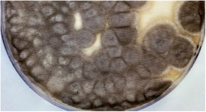 Pure culture of Scedosporium apiospermum growing on a Sabouraud glucose agar plate supplemented with chloramphenicol and inoculated with nasal biopsy material from a dog with scedosporiosis.2 Note the cottony appearance of the colonies.