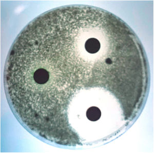 Antifungal susceptibility testing of the Scedosporium apiospermum strain isolated from the dog with scedosporiosis,2 using a diffusion technique. The largest zone of inhibition was obtained with ketoconazole and the smallest with clotrimazole. Itraconazole showed no inhibition zone.
