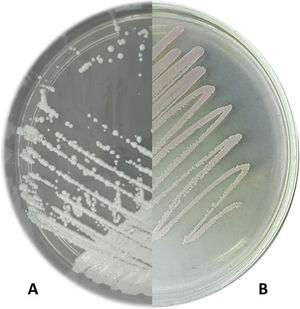 Crecimiento del aislamiento de Cyberlindnera fabianii a las 24h a 37°C en SDA (A) y CHROMagar Candida (B).