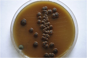 Chocolate brown yeast-like colonies of Cryptococcus neoformans sensu stricto on niger seed (Guizotia abyssinica) medium, isolated from the CSF after 72h of incubation at 28°C.