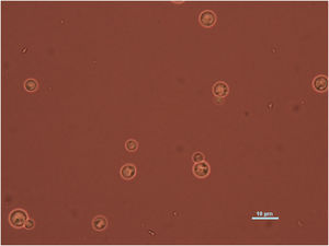 India ink mount showing encapsulated spherical, budding yeast cells of Cryptococcus neoformans sensu stricto isolated from the CSF sediment (1000×).