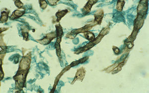 Histological section of a cutaneous lesion from a trout with saprolegniosis. Note the broad irregularly shaped non-septate hyphae present in the skin. Grocott stain. © F. Javier Cabañes.