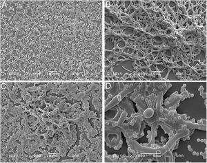 Analysis of biofilms by SEM. Biofilm formation in Lab-Tek II Chamber Slide System for: (A) S. aureus (1000×), (B) C. albicans (1000×), (C) C.albicans and S. aureus (1000×), and (D) C.albicans and S. aureus (5000×). This experiment was repeated twice in triplicate.
