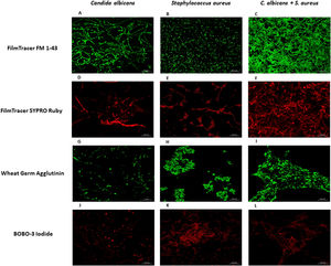 Analysis by confocal microscopy of the S. aureus and C. albicans mono- and polymicrobial biofilms. Biofilms were stained with the next reagents: (A, B, and C) FilmTracer FM 1-43 Green Biofilm cell stain. (D, E, and F) FilmTracer SYPRO Ruby biofilm matrix stain. (G, H, and I) wheat germ agglutinin, Alexa Fluor 488 Conjugate. (J, K, and L) BOBO-3 Iodide. This experiment was repeated twice in triplicate.
