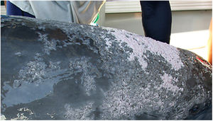 Dermal lesions in a bottlenose dolphin with lobomycosis. Note the typical verrucous appearance with ulcerations and crusts. Photo courtesy of Dr. Gregory D. Bossart, Georgia Aquarium, Atlanta, Georgia, USA.