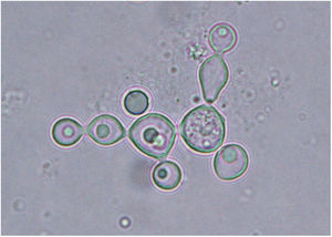 Detail of a KOH wet mount preparation of a dermal specimen from a bottlenose dolphin with lobomycosis, showing the characteristic yeast cells in chains. Photo courtesy of Professor Leonel Mendoza, Michigan State University, USA.