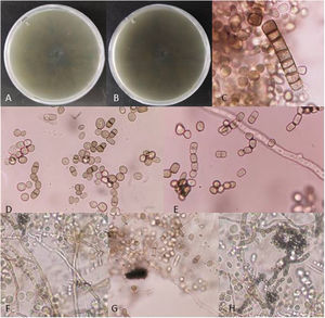 Colony growth on SDA after 7 days at 25°C. A: reverse side; B: surface side; C: arthroconidia; D, E: uni- to tricellular dark arthroconidia; F, G: hyaline hyphae; H: chain of arthroconidia.