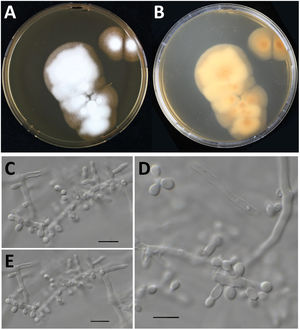 Culture characteristics of Nannizziopsisarthrosporioides CBS 118890. Panels A and B: Culture onto malt extract agar incubated for two-weeks at 35°C, colony is about 5cm in diameter, velvety to powdery (panel A, obverse; panel B, reverse). Panels C–E: Microscopy of a two-week old N. arthrosporioides culture showing aleuriospores and subglobose spores, scale bar=10μm.