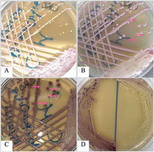Mixed growth of Candida glabrata (mauve colonies) and Candida parapsilosis (white colonies; pink arrow marks) on CHROMagar Candida plate incubated at 30 ̊C after 24 h of incubation (A); 48 h of incubation (B); and 72 h of incubation (C). D: Pure cultures of both isolates on CHROMagar Candida after 48 h of incubation.