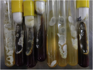 Whitish cottony colonies with an incipient brown hue in the culture media after seven days of incubation at 28°C and 37°C.