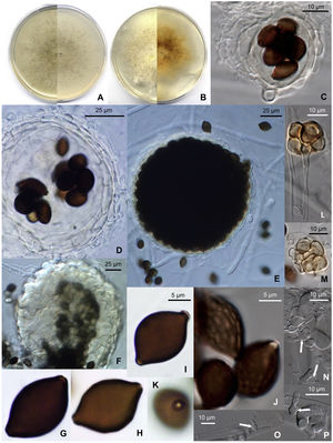 Microthecium pleomorphosporum (CBS 148652). (A) Colony after 14 days at 25°C on PCA (front and reverse). (B) Colony after 14 days at 25°C on PDA (front and reverse). (C and D) Translucent ascomata showing the peridial layers and eight ascospores within the asci. (E) Broad ascoma. (F) Detail of the peridial wall. (G–I) Smooth-walled ascospores. (J) Reticulate ascospores. (K) Donut-like structure surrounding the germ pore of an ascospore. (L and M) Bulbils. (N and P) Phialidic conidiogenous cells (white arrows) with catenate conidia.