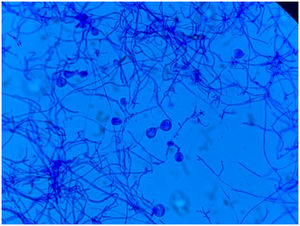 Lactophenol blue stain of Inonotus levis.