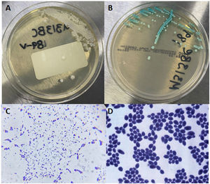Isolation from blood culture. (A) White, creamy, smooth, glabrous, yeast-like colonies in agar Sabouraud, typical of Candida species. (B) Colonies with identical appearance showing green color in CHROMagar (Becton Dickinson; Franklin Lakes, NJ, USA), characteristic of C. albicans. (C) Gram stain observed at 100×. (D) 1000×.