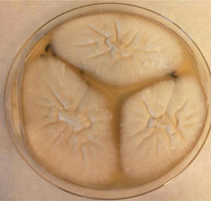 Isolation of Aspergillus hiratsukae on potato dextrose agar (PDA).