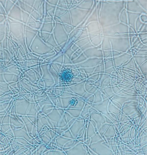 Conidial heads of Aspergillus hiratsukae in a preparation with Lactophenol blue stain and scotch tape.