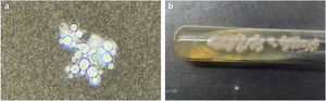(a) Microscopic view of the clinical material showing encapsulated yeast cells. (b) Macroscopic morphology of the fungal colonies grown in culture.